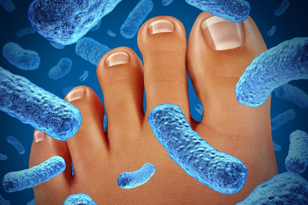 грибок ногтей