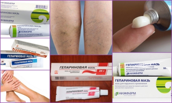 Гепариновая мазь при варикозе и тромбофлебите