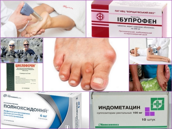Главные методы в лечении бурсита стопы