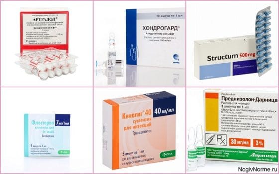 Хондропротекторы и кортикостероидные препараты 