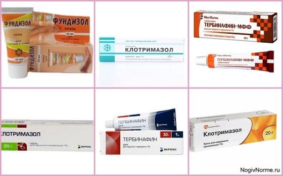 Использование Фундизола, Тербинафина и Клотримазола при лечении ног