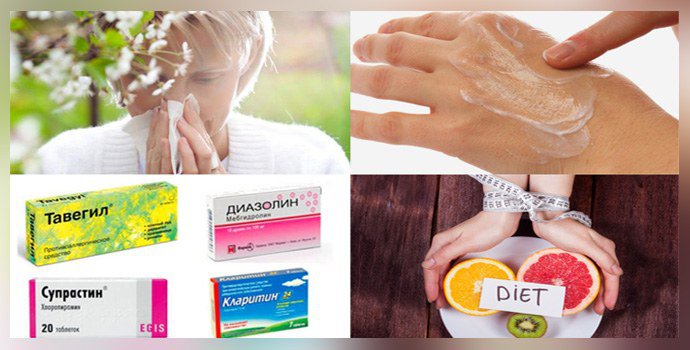 Лечение аллергии и псориаза Лечение аллергии и псориаза