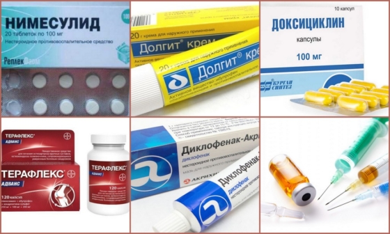 Лечение при хондропатии