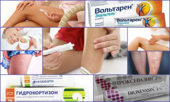 Мази при варикозе и тромбофлебите