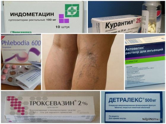 Медицинские препараты от варикоза вен