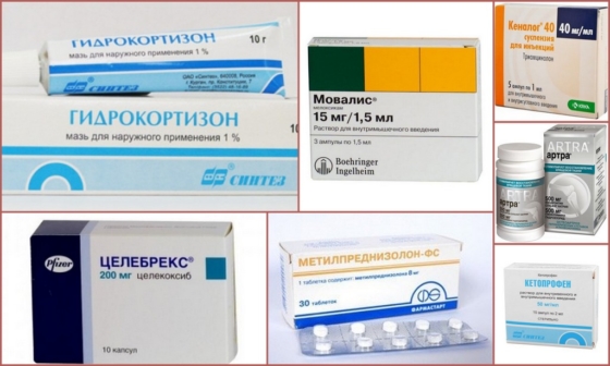 Медикаменты для устранения боли в суставе большого пальца