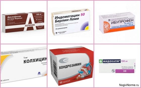 Медикаменты при лечении ревматоидного артрита и подагры