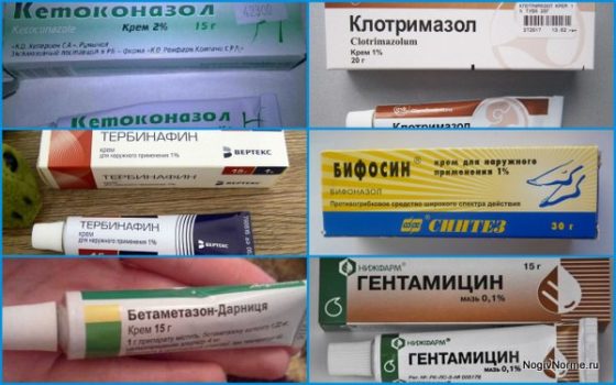 Различные кремы и мази от грибка на пальцах ног
