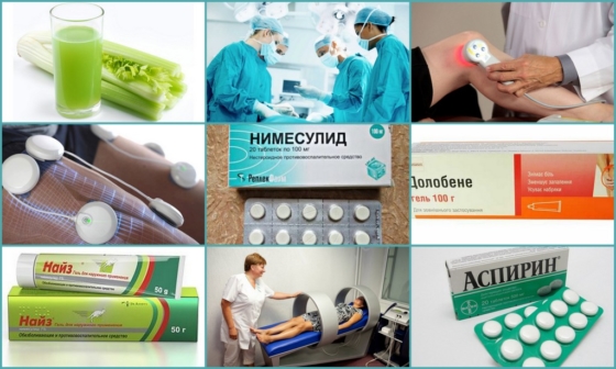 Методы лечения бурсита гусиной лапки