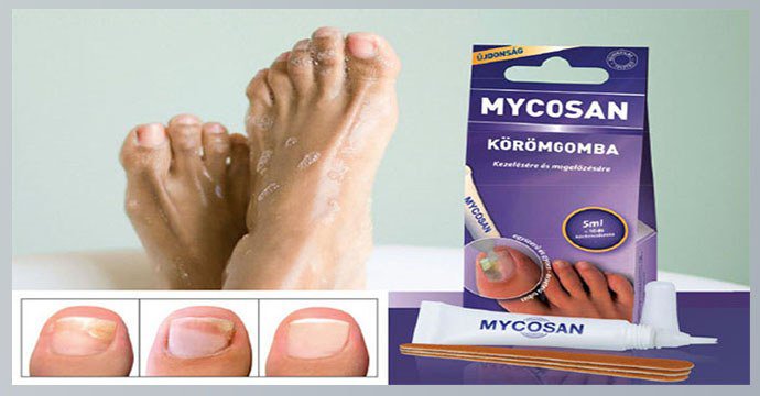 Микозан