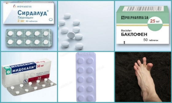 Популярные миорелаксанты при судорогах