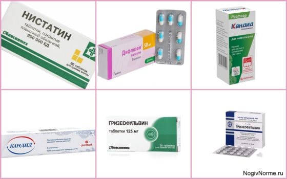 Недорогие антимикотики при лечении патологии