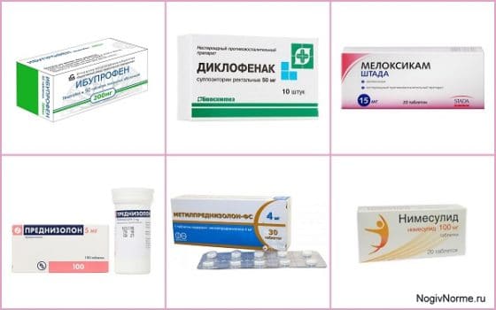 НПВС и глюкокортикостероиды при артрите