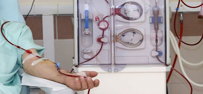 плазмаферез при псориазе плазмаферез при псориазе