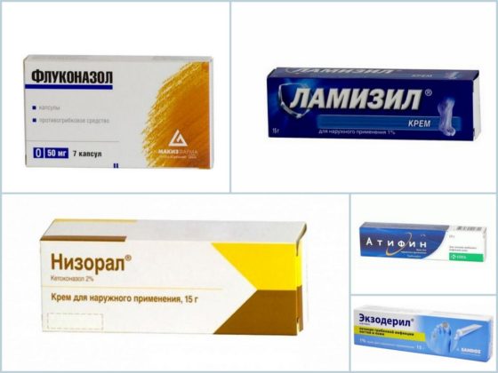 Популярные аналоги противогрибкового лака Лоцерил