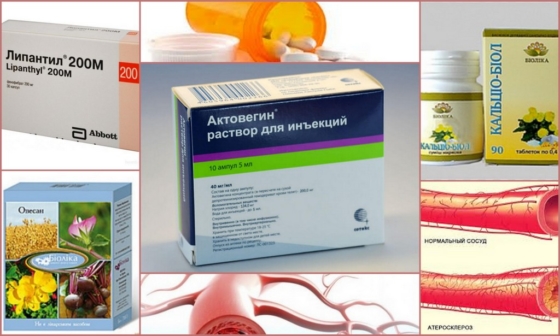 Препараты для лечения атеросклероза сосудов ног