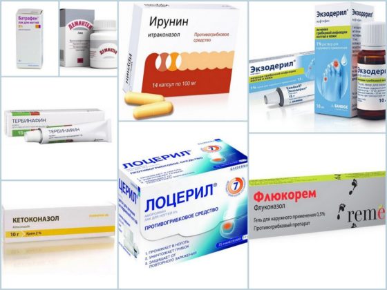 Препараты от грибка ногтей, рекомендуемые Еленой Малышевой