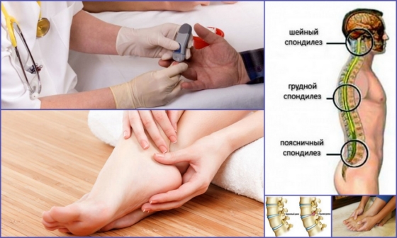 Причины, провоцирующие онемение стоп