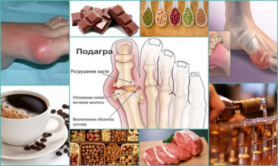 Продукты, способствующие развитию подагры