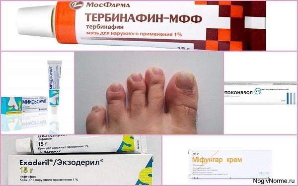 Противогрибковые крема и лаки для ног