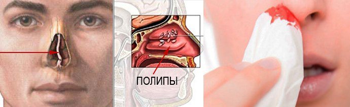 противопоказания к применению