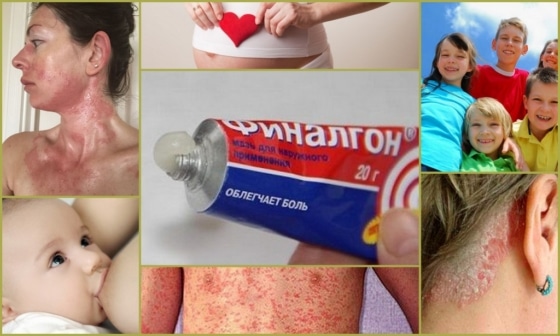 Противопоказания к использованию финалгона