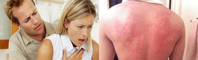 характерные симптомы
