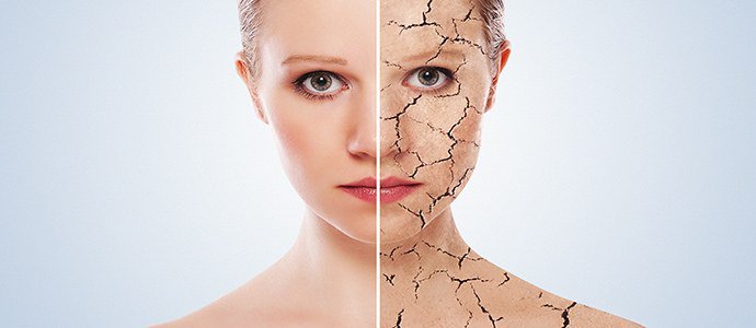 псориатическая эритродермия псориатическая эритродермия