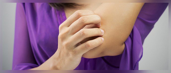 Зуд при псориазе Зуд при псориазе