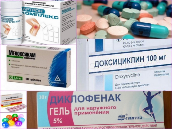 Медикаменты для лечения артрита голеностопа