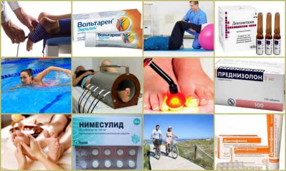 Распространенные способы лечения онемения в ногах