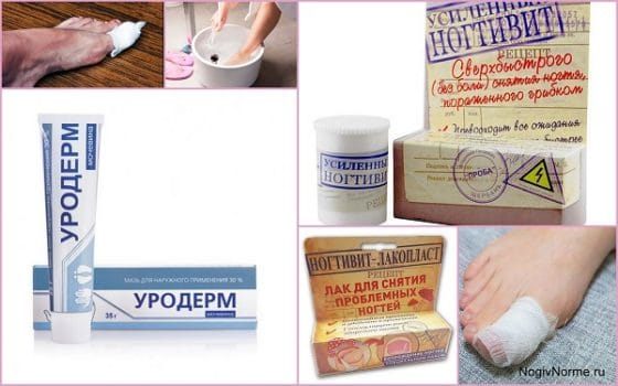 Размягчение ногтей Ногтивитом и Уродермом