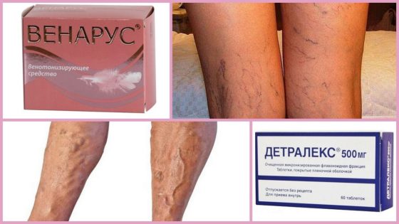 Препараты аналоги - Венарус и Детралекс