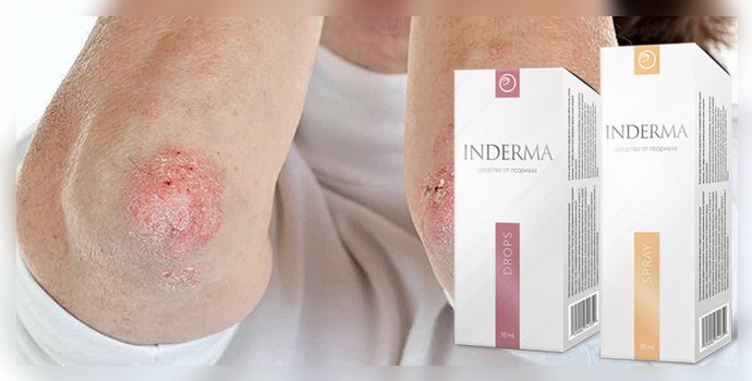 inderma от псориаза