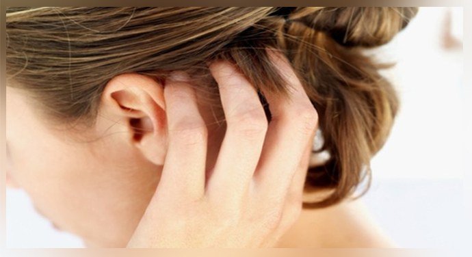 Зуд на голове Зуд на голове